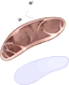 Carne Estragada